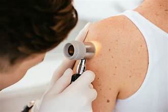 Expert Skin Cancer and Dermatology Treatments in Dubai