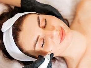 Expert Mole Removal Treatments in Dubai