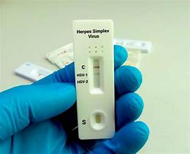 Rapid Herpes Test and STD Dermatology Treatments in Dubai