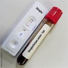 Rapid Herpes Test and STD Dermatology Treatments in Dubai