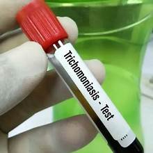 Trichomoniasis and STD Testing Services in Dubai at Cosmocare Medical Center