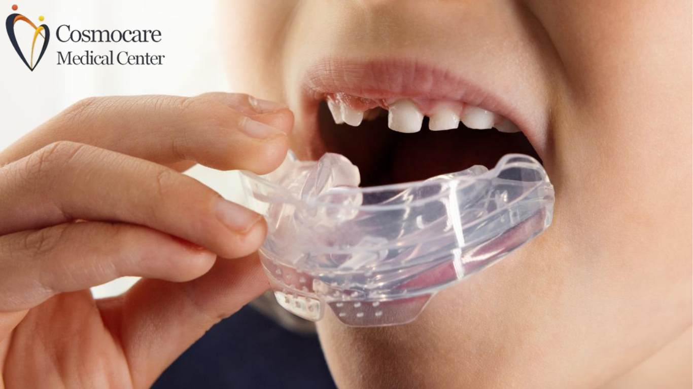 Palatal Expander Treatment Dubai by Cosmocare Medical Center