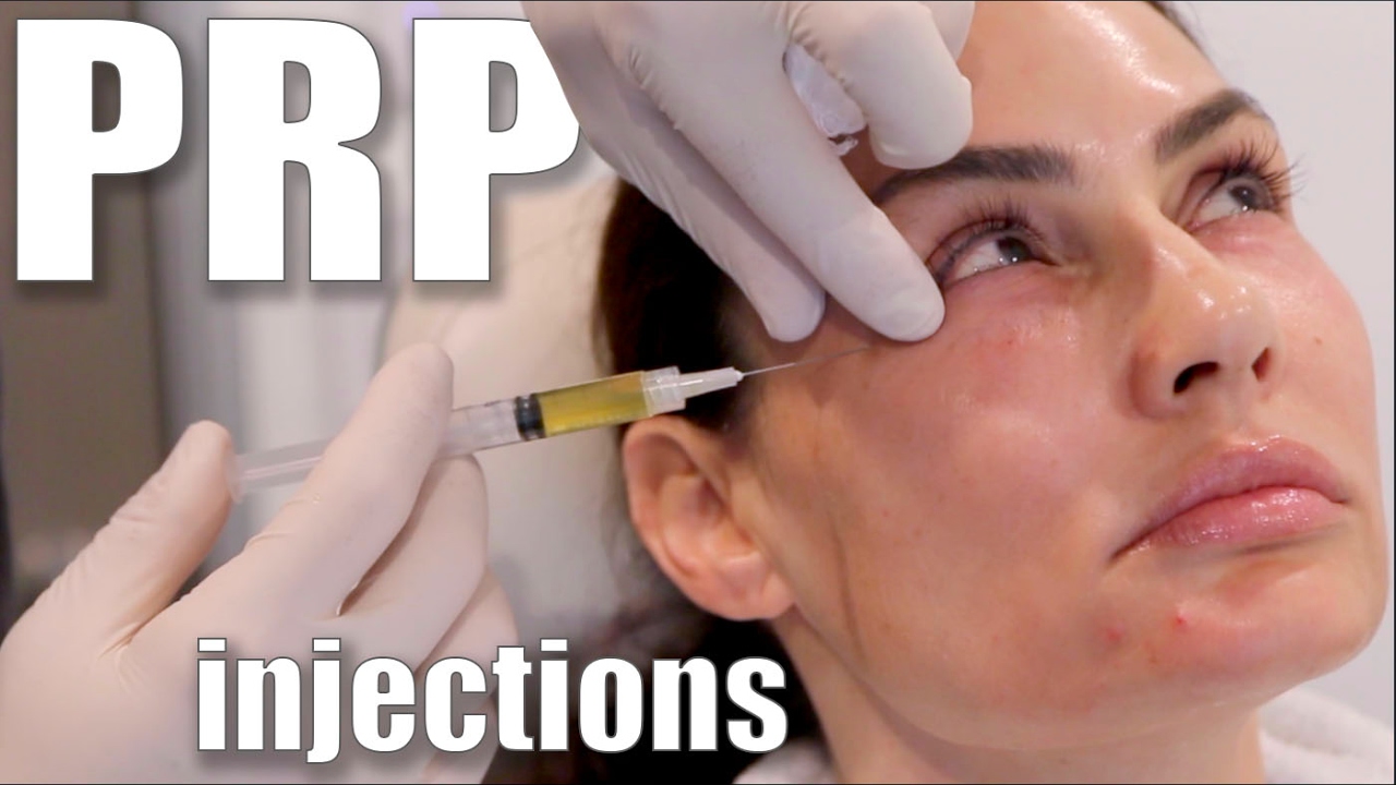 PRP treatment for lower face in Dubai