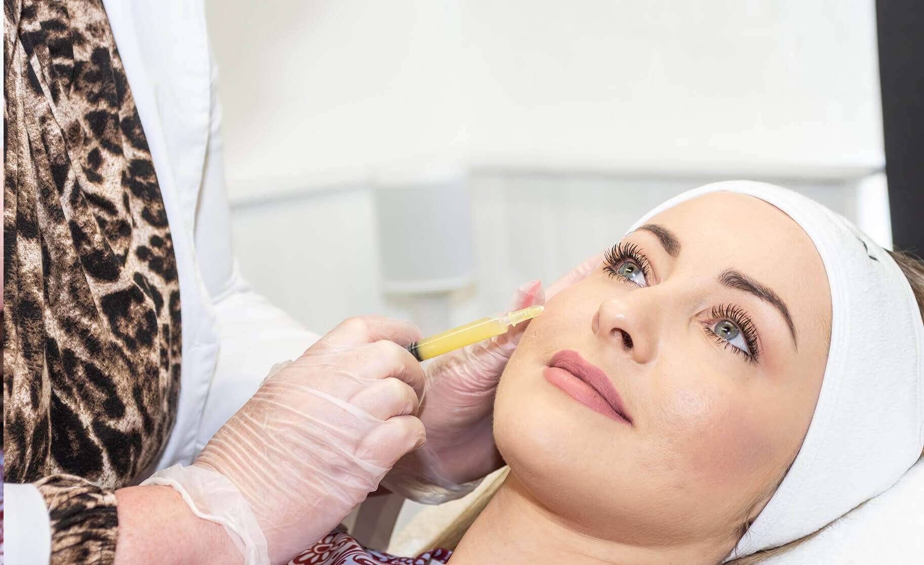 PRP treatment for mid-face in Dubai