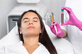 PRP treatment for sun damage in Dubai